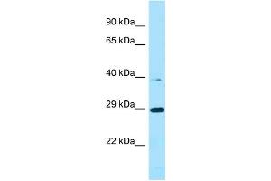 WB Suggested Anti-PROCA1 Antibody Titration: 1. (PROCA1 抗体  (C-Term))