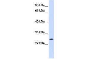 WB Suggested Anti-NOL3 Antibody Titration:  0.