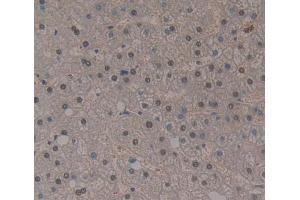Used in DAB staining on fromalin fixed paraffin- embedded liver tissue (THYN1 抗体  (AA 1-225))