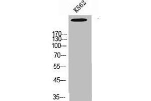Western Blot analysis of K562 cells using Talin-1 Polyclonal Antibody (TLN1 抗体  (C-Term))