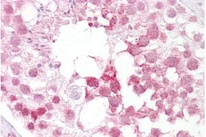 Immunohistochemistry with Testis tissue at an antibody concentration of 5µg/ml using anti-Ift88 antibody (ARP53657_P050) (IFT88 抗体  (N-Term))