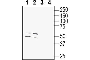 Western blot analysis of mouse brain lysates (lanes 1 and 3) and rat brain membranes (lanes 2 and 4): 1-2. (Cannabinoid Receptor 1 (CNR1) Peptide)