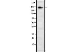 Western blot analysis of ALPK3 using K562 whole cell lysates (ALPK3 抗体  (C-Term))