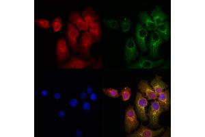 ABIN6259451 and ABIN6274942 staining Hela cells by IF/ICC. (ARPP21 抗体  (Internal Region))