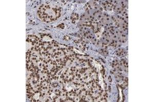 Immunohistochemical staining of human pancreas with CSDC2 polyclonal antibody  shows strong nuclear positivity in both exocrine glandular cells and Islet cells. (CSDC2 抗体)