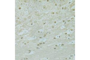 Immunohistochemistry of paraffin-embedded mouse brain using RCC1 antibody. (RCC1 抗体  (AA 1-240))