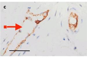 IHC Validation of Envelope in COVID-19 Patient Skin: (Magro et al. (SARS-CoV-2 Envelope 抗体  (N-Term))