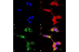 Immunocytochemistry/Immunofluorescence analysis using Mouse Anti-NALCN Monoclonal Antibody, Clone S187-7 (ABIN2483034). (NALCN 抗体  (AA 1659-1738) (PE))