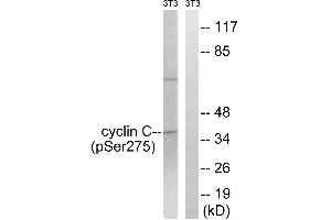 Immunohistochemistry analysis of paraffin-embedded human breast carcinoma tissue using Cyclin C (Phospho-Ser275) antibody. (Cyclin C 抗体  (pSer275))