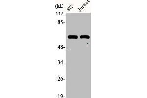 Western Blot analysis of NIH-3T3 Jurkat cells using Cytokeratin 10 Polyclonal Antibody (Cytokeratin 1 抗体  (Internal Region))