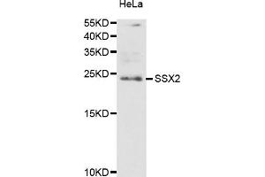 Western blot analysis of extracts of HeLa cells, using SSX2 antibody (ABIN5974203) at 1/1000 dilution. (SSX2 抗体)