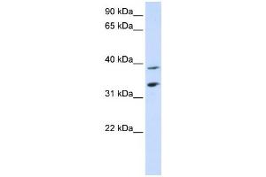 Western Blotting (WB) image for anti-Solute Carrier Family 25, Member 34 (SLC25A34) antibody (ABIN2458822) (SLC25A34 抗体)