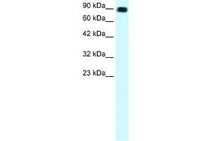 WB Suggested Anti-C13ORF8 Antibody Titration: 1. (ZNF828 抗体  (Middle Region))