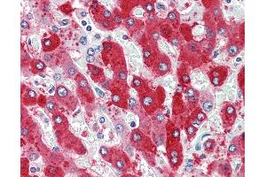 Human, Liver: Formalin-Fixed Paraffin-Embedded (FFPE) (CDCP1 抗体  (N-Term))