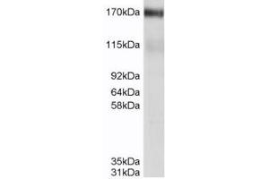 ABCC4 抗体  (C-Term)