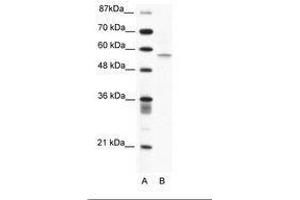 Image no. 1 for anti-Programmed Cell Death 4 (PDCD4) (N-Term) antibody (ABIN203165) (PDCD4 抗体  (N-Term))