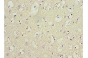Immunohistochemistry of paraffin-embedded human brain tissue using ABIN7165131 at dilution of 1:100 (Nerve Growth Factor Receptor (TNFRSF16) Associated Protein 1 (NGFRAP1) (AA 1-111) 抗体)