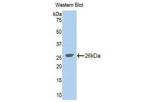 Western Blotting (WB) image for anti-Glycine Dehydrogenase (GLDC) (AA 627-833) antibody (ABIN1859022) (GLDC 抗体  (AA 627-833))
