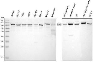 Western blot analysis of EEF2 using anti-EEF2 antibody (ABIN7599561).