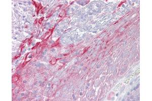 Anti-CFP / Properdin antibody IHC of human tonsil. (CFP 抗体  (AA 35-84))