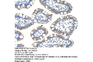 Rabbit Anti-SF3B4 Antibody  Paraffin Embedded Tissue: Human Intestine Cellular Data: Epithelial cells of intestinal villas Antibody Concentration: 4. (SF3B4 抗体  (N-Term))