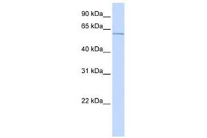 ME2 antibody used at 1 ug/ml to detect target protein. (NAD-ME 抗体)