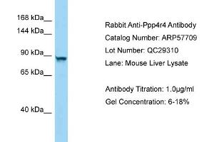 Western Blotting (WB) image for anti-Protein Phosphatase 4, Regulatory Subunit 4 (PPP4R4) (C-Term) antibody (ABIN2787350) (PPP4R4 抗体  (C-Term))