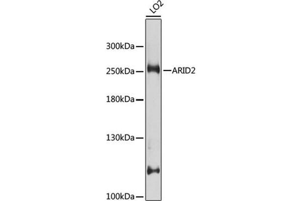 ARID2 抗体  (AA 1586-1835)