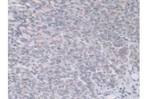 IHC-P analysis of Mouse Stomach Tissue, with DAB staining. (ADAMTS7 抗体  (AA 226-437))