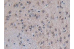 DAB staining on IHC-P; Samples: Mouse Brain Tissue (p300 抗体  (AA 2124-2397))