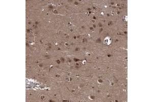 Immunohistochemical staining of human cerebral cortex with SYCP2L polyclonal antibody  shows distinct cytoplasmic and nuclear positivity in neuronal cells at 1:200-1:500 dilution. (SYCP2L 抗体)