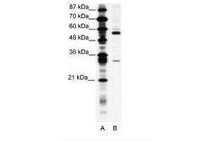 Image no. 1 for anti-Coronin, Actin Binding Protein, 1A (CORO1A) (C-Term) antibody (ABIN305990) (Coronin 1a 抗体  (C-Term))