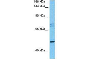 Host:  Mouse  Target Name:  PKD2  Sample Tissue:  Mouse Heart  Antibody Dilution:  1ug/ml (PKD2 抗体  (N-Term))