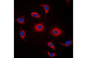 Immunofluorescent analysis of GPR119 staining in HeLa cells. (G Protein-Coupled Receptor 119 抗体  (Center))
