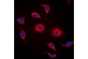 Immunofluorescent analysis of GPR119 staining in HeLa cells. (G Protein-Coupled Receptor 119 抗体  (Center))