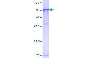 RPN1 Protein (AA 24-607) (GST tag)
