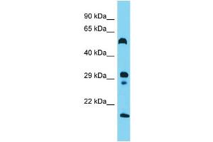Host: Rabbit  Target Name: Hrh3  Sample Tissue: Rat Small Intestine lysates  Antibody Dilution: 1. (HRH3 抗体  (N-Term))