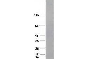 Western Blotting (WB) image for Phospholipase C, epsilon 1 (PLCE1) protein (Myc-DYKDDDDK Tag) (ABIN2729133)