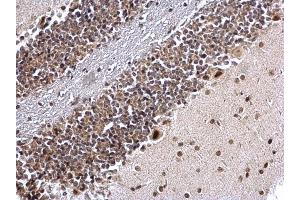 Immunohistochemistry (IHC) image for anti-Nuclear Receptor Subfamily 2, Group F, Member 1 (NR2F1) (N-Term) antibody (ABIN2855957)