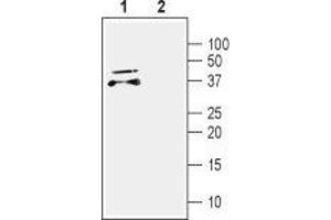 Western blot analysis of mouse brain lysate: - 1. (CDNF 抗体  (Mature))