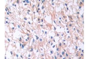Used in DAB staining on fromalin fixed paraffin- embedded kidney tissue (IL13 Receptor alpha 1 抗体  (AA 203-376))