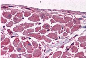 Human Heart: Formalin-Fixed, Paraffin-Embedded (FFPE) (MBNL1 抗体  (AA 1-383))