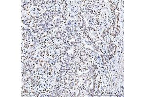 IHC analysis of MCM6 using anti-MCM6 antibody (ABIN7600038). (MCM6 抗体  (AA 14-821))