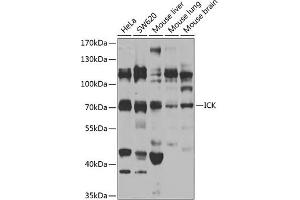Western blot analysis of extracts of various cell lines, using ICK antibody (ABIN6130510, ABIN6142127, ABIN6142128 and ABIN6223738) at 1:1000 dilution. (ICK 抗体  (AA 1-270))