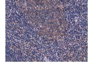 Image no. 8 for anti-COBW Domain Containing 1 (CBWD1) antibody (ABIN1497117) (CBWD1 抗体)