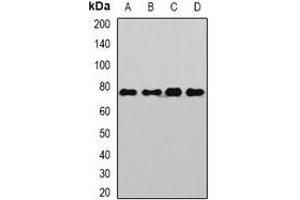 Western blot analysis of Sp110 expression in Jurkat (A), Hela (B), mouse liver (C), rat brain (D) whole cell lysates. (SP110 抗体)