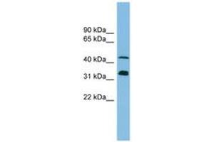 Image no. 1 for anti-Golgi Reassembly Stacking Protein 1, 65kDa (GORASP1) (AA 35-84) antibody (ABIN6745200) (GORASP1 抗体  (AA 35-84))