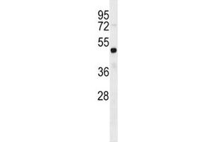 FEZF2 antibody western blot analysis in HL-60 lysate. (FEZF2 抗体  (AA 209-237))