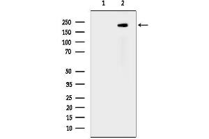 Western blot analysis of lysates from Hela cells(heat-shock treatment), using Phospho-Tuberin/TSC2 (Ser1387) Antibody.