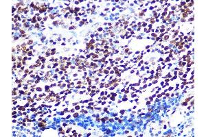 Immunohistochemistry of paraffin-embedded human appendix using K/H Rabbit mAb (ABIN7267702) at dilution of 1:100 (40x lens). (HAT1 抗体)